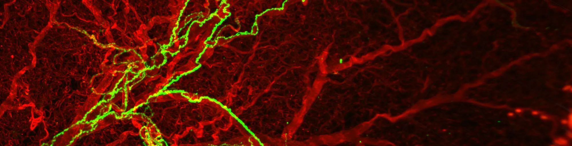 Molecular Basis of Cancer